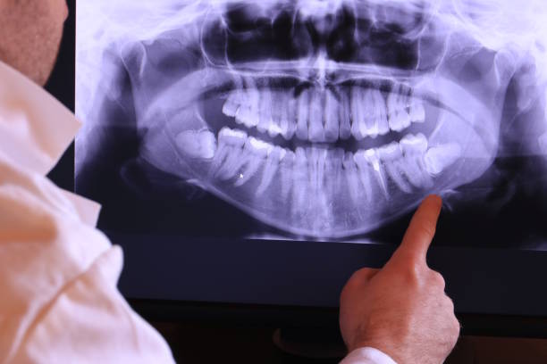 Best Broken Tooth Emergency  in Rainbow Lakes, NJ