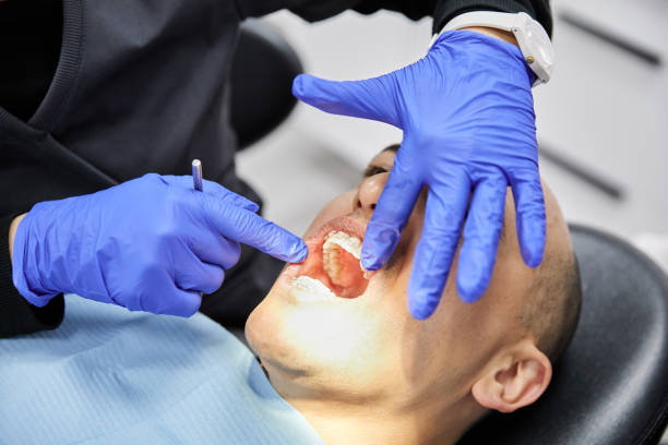 Best Chipped Tooth Repair Near Me  in Rainbow Lakes, NJ
