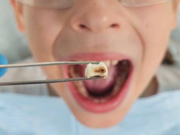 Best Tooth Infection Emergency Dentist  in Rainbow Lakes, NJ
