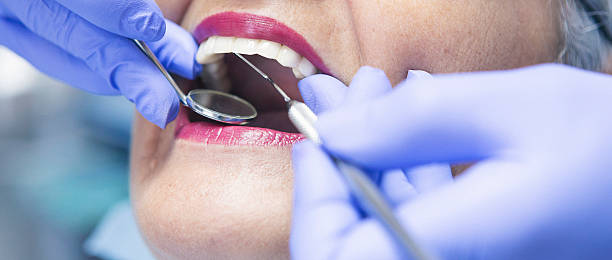Emergency Dental Filling Replacement in NJ