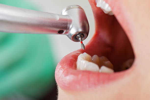 Best Knocked-Out Tooth Emergency  in Rainbow Lakes, NJ